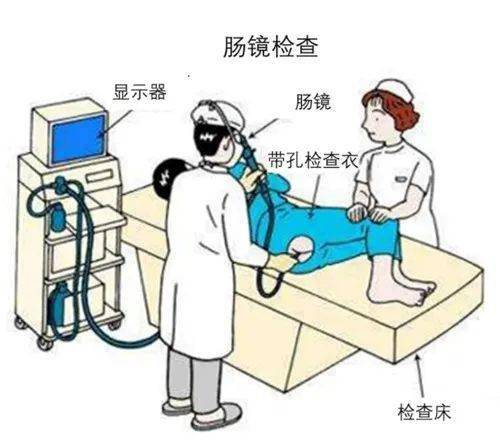 肛肠自检 | 这五类人，需要做肠镜检查