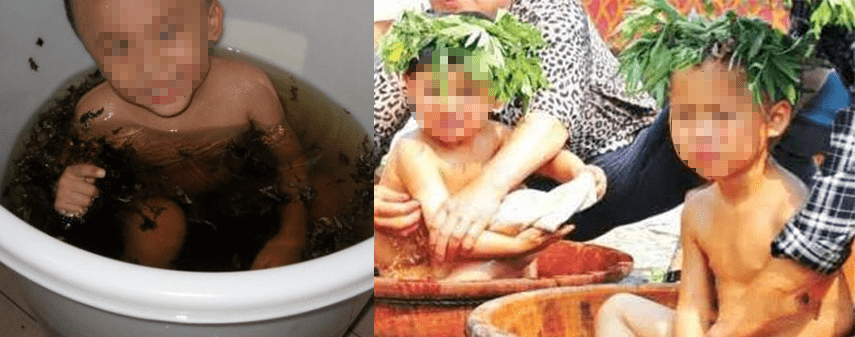 痘痘|夏天变黑长痘不可怕，赶紧用它，让你的皮肤恢复婴儿的光滑，痘痘，黑头，螨虫全都消失了