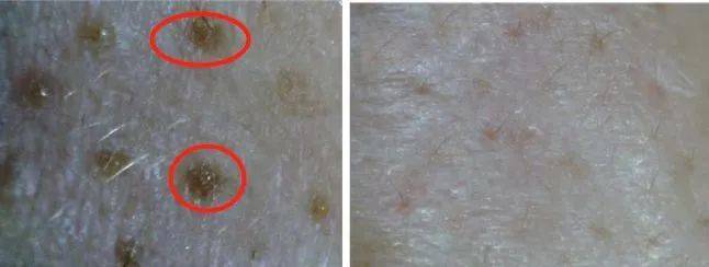 潘达|日本20年老木头,经1300°高温烧成“变态黑炭”,几分钟溶掉黑头,太神奇!