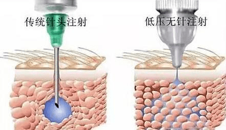 小气泡|花9块钱在福州这家店做了医美,做完就后悔了!