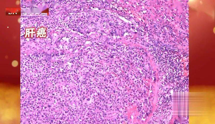 怎么护肝最好最快 9fa09484b75949dd9182d96f21cb6f78.jpeg