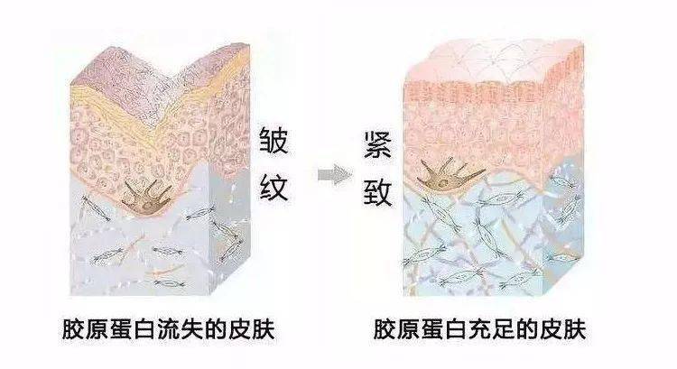 美容|以色列美容仪太牛！千万红人都用它提拉、导入、清洁，还有18K真金护理头