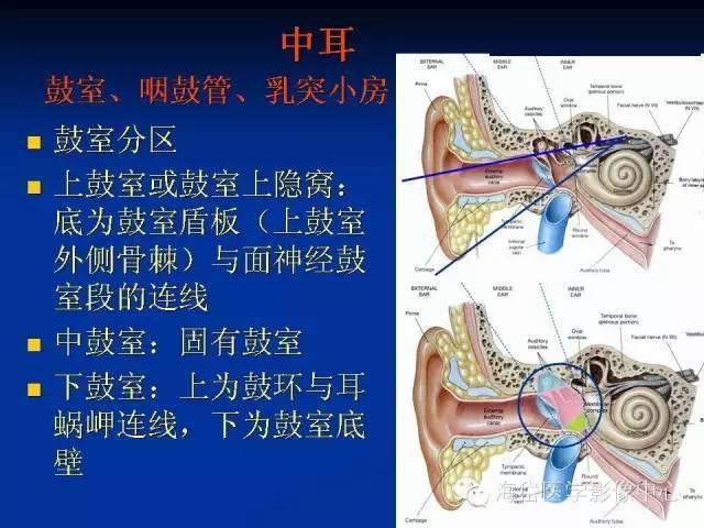 耳部ct及mri解剖