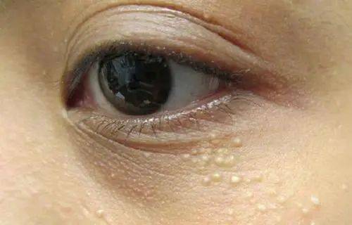 黑眼圈|实名推荐这款国货眼霜,99元去掉20年的熊猫眼,还不长脂肪粒!