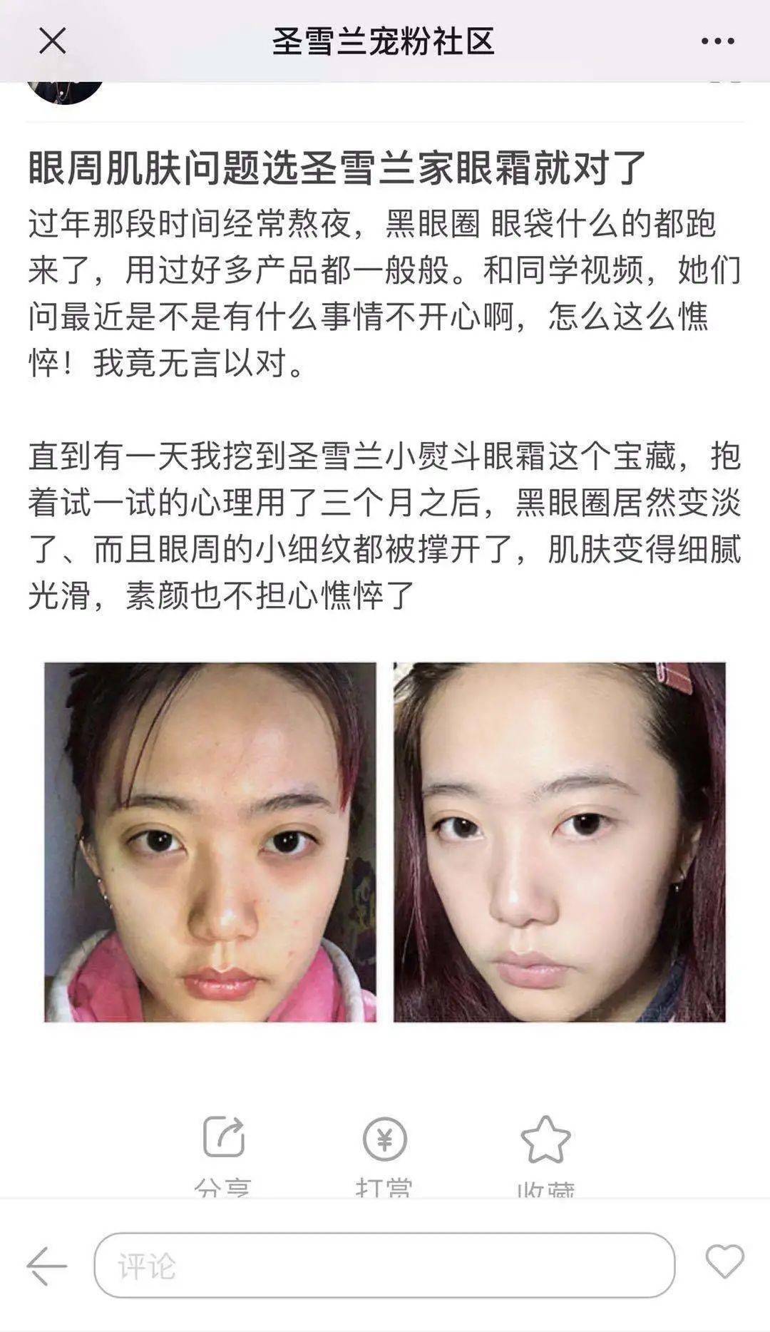 黑眼圈|实名推荐这款国货眼霜,99元去掉20年的熊猫眼,还不长脂肪粒!