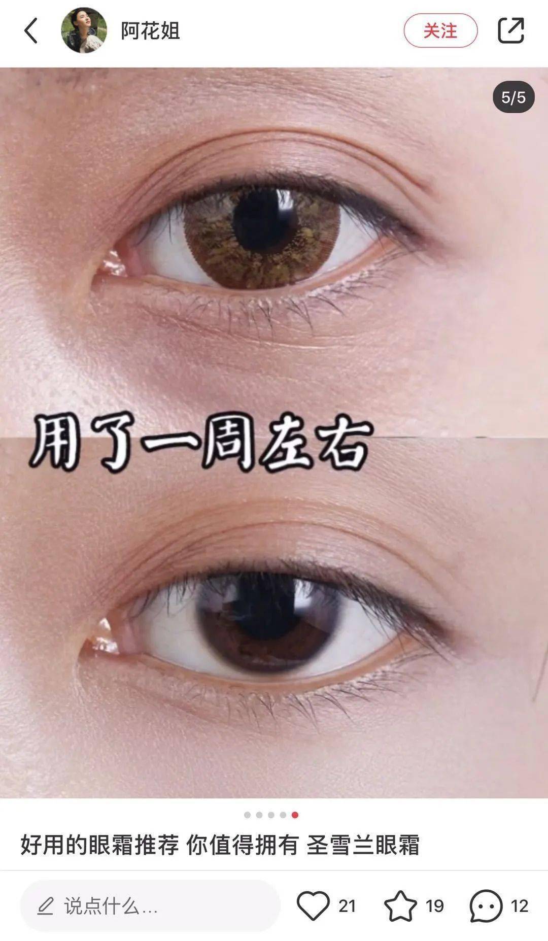 黑眼圈|实名推荐这款国货眼霜,99元去掉20年的熊猫眼,还不长脂肪粒!