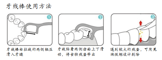 使用牙线时间最好在每日餐后. 2.滑入牙线要小心,避免损伤牙龈. 3.