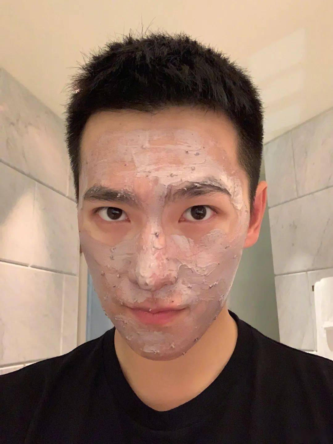 张天|长期闭口、粉刺、痘痘满脸的人，微镜头下毛孔竟然是这样的！赶紧get林允、张天爱的0毛孔秘籍吧！