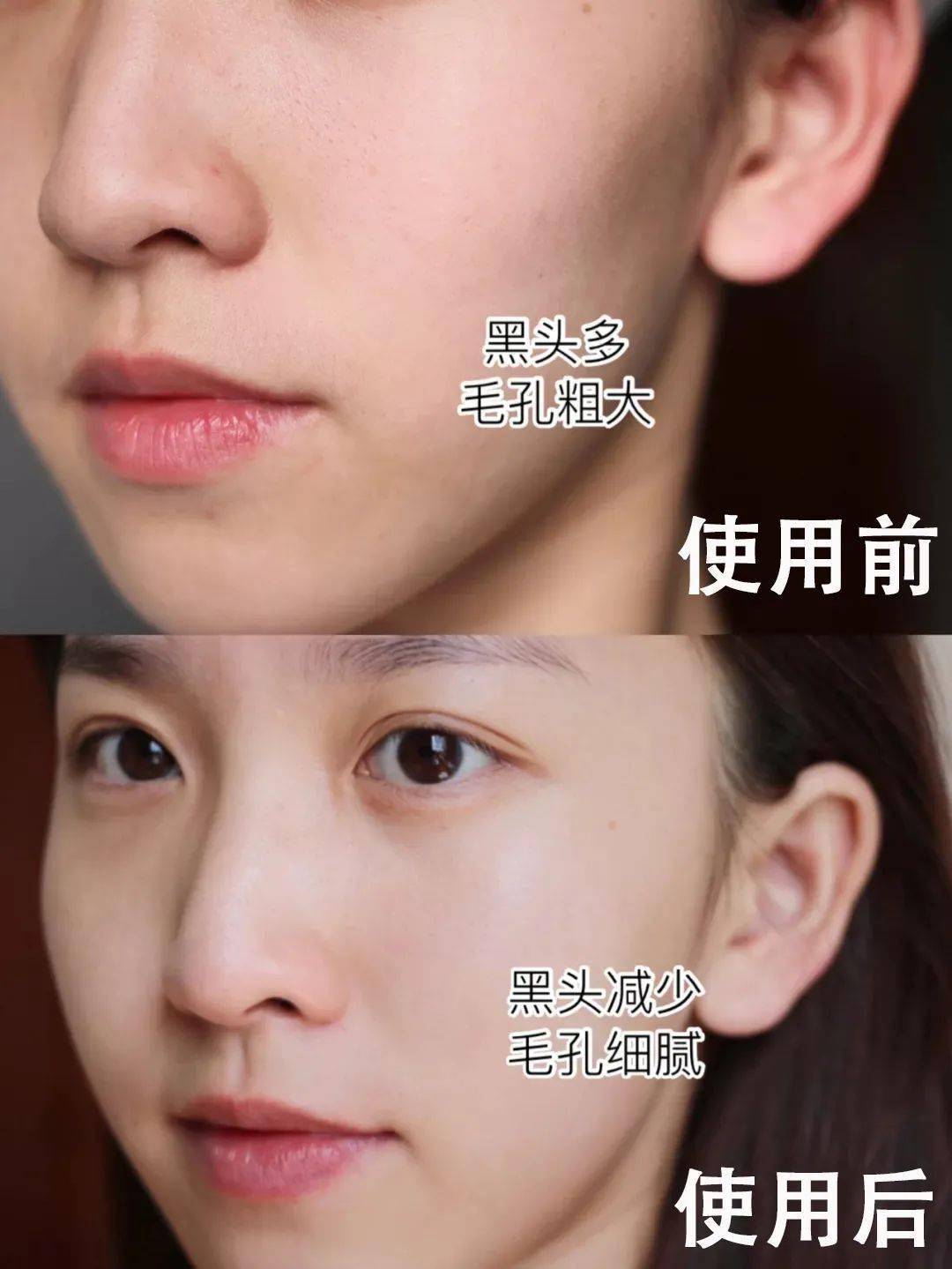 皮肤|翻红女星这都几年没接戏了，还敢这么浪呢？