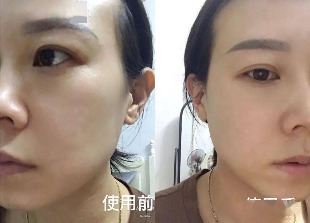 Bug|寻芳记｜换季肤况出Bug？听说比奶茶还甜的她们都用这招！