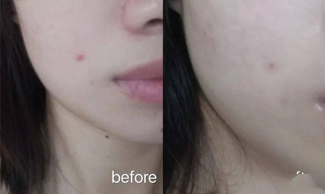 Bug|寻芳记｜换季肤况出Bug？听说比奶茶还甜的她们都用这招！