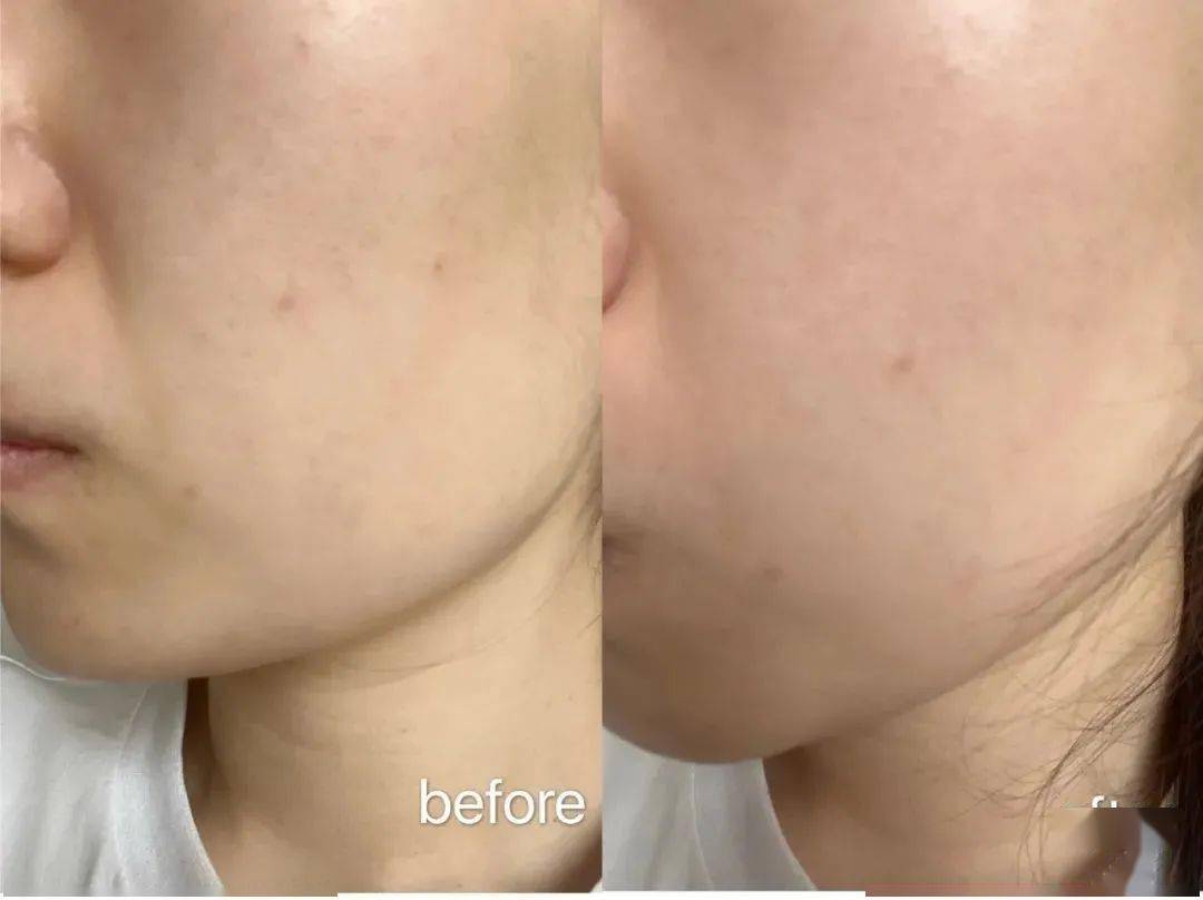 Bug|寻芳记｜换季肤况出Bug？听说比奶茶还甜的她们都用这招！