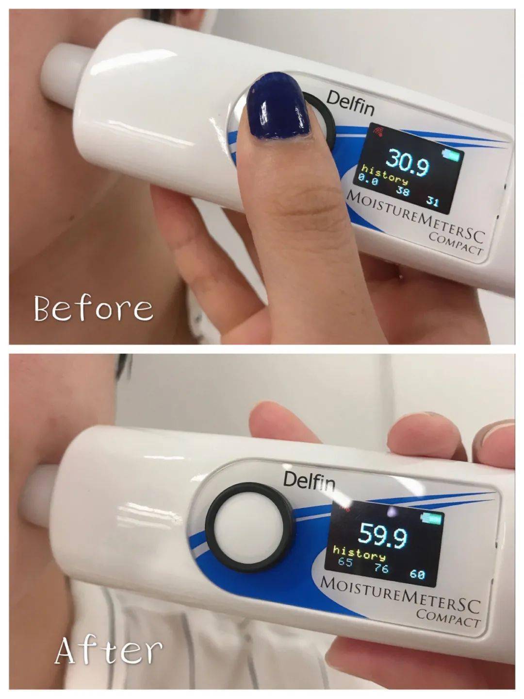 肌肤|别人换季先换装,我却先换脸?