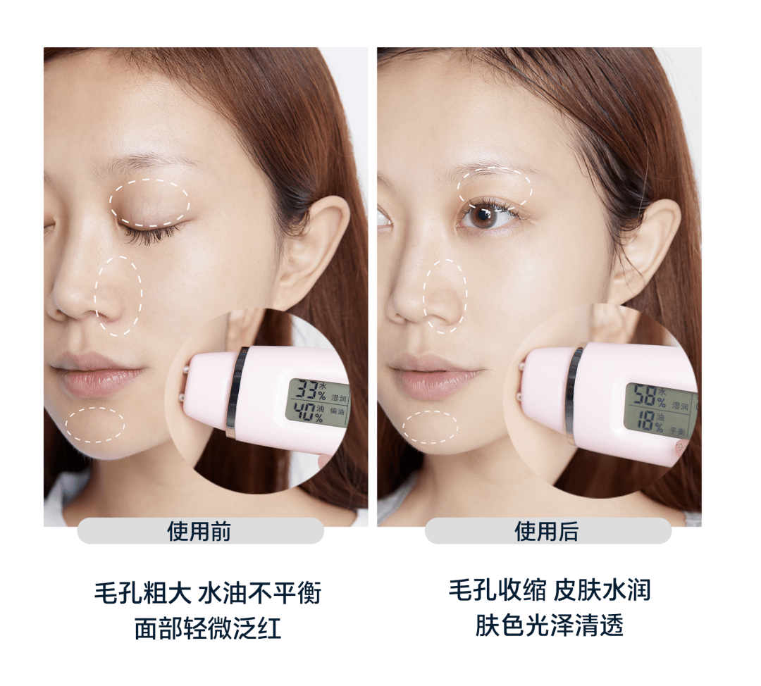 肌肤|别人换季先换装,我却先换脸?