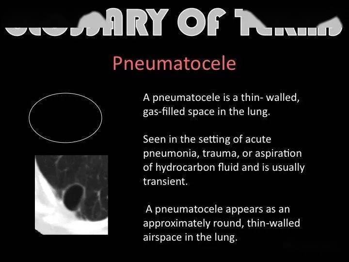 再看看  《core radiology:a visual approach to diagnostic