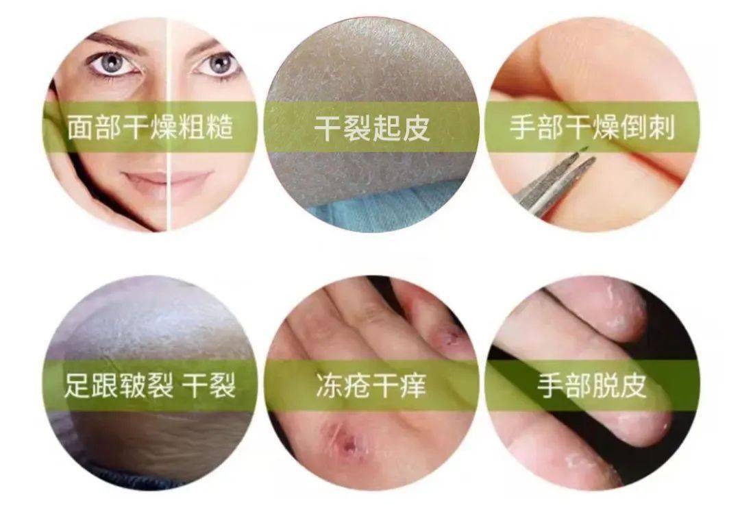 拖鞋|爱穿凉鞋、拖鞋出门的女人,脚上露出这个东西也太丑了吧~