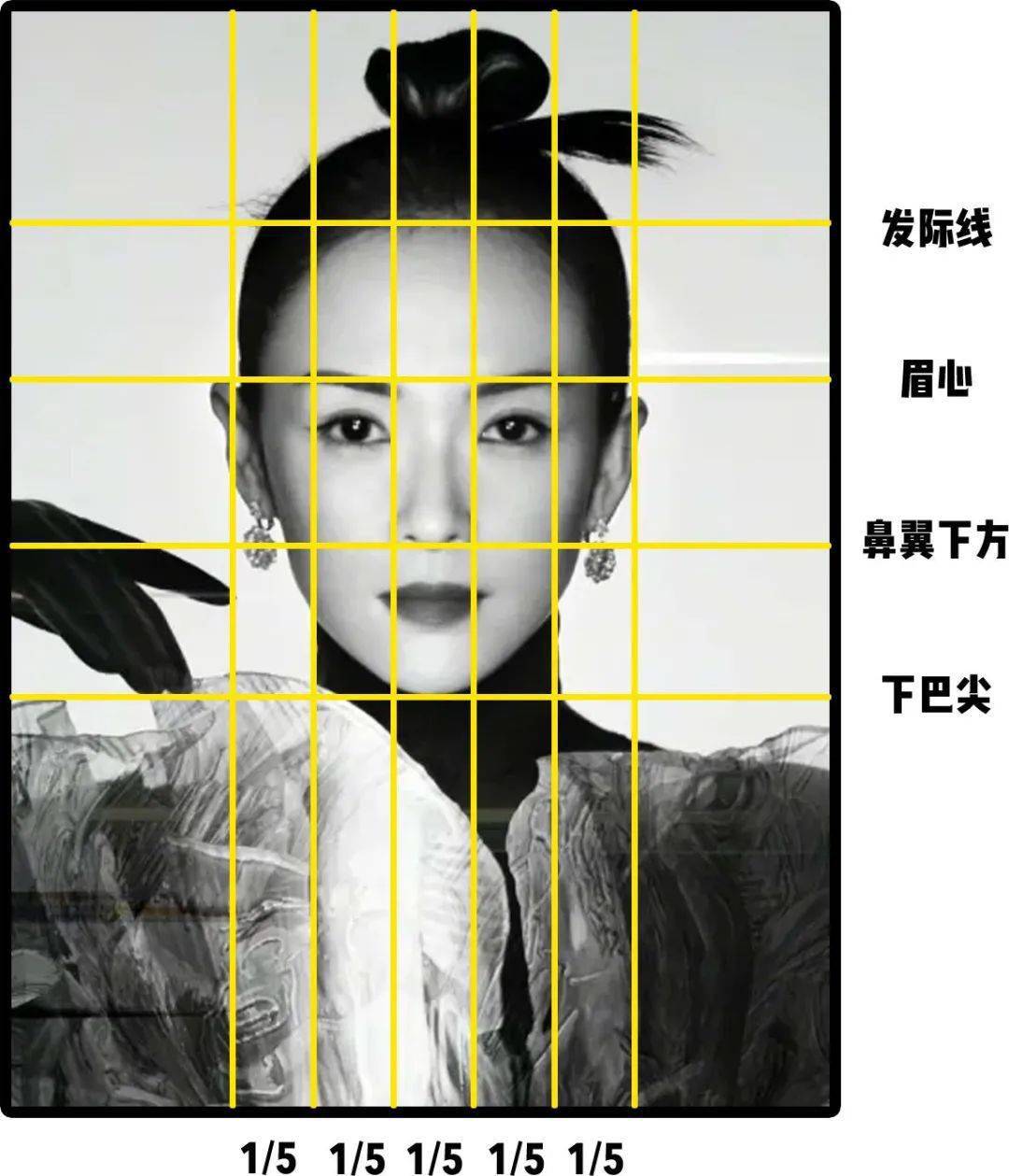 移植|国庆回去，我打算植发了！