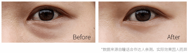 黑眼圈|430年的马应龙放大招,八宝古方做的眼霜,眼纹淡了