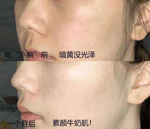 少女|春风吹人老，闲来嚼嚼它，补充胶原蛋白，50岁也能嫩回少女脸~