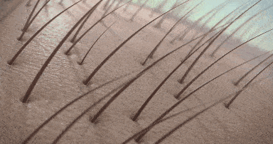 头发|头皮发痒，出油，还掉发？原来是你的洗发水没选好...