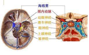 边跑边繁殖,最后组成一支强大的细菌队伍"入侵"颅内海绵窦