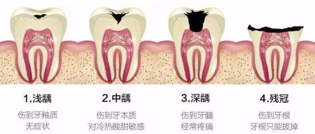 关晓彤|曾被全网嘲“土low”的关晓彤，摆脱ta后竟让人再也黑不起来，这才是该被捧在手心上的“国民闺女”啊！！！