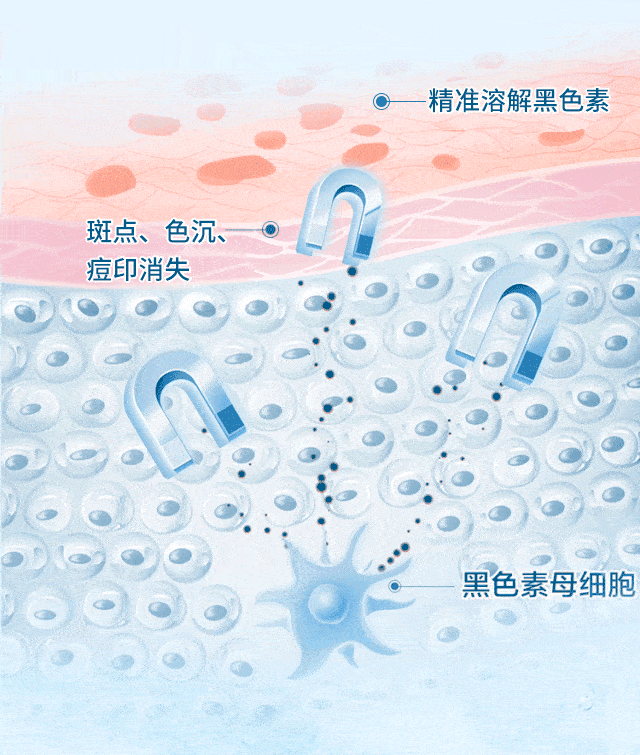 女人|如果你正长“色斑”,试试这个新方法,惊喜到让你尖叫!