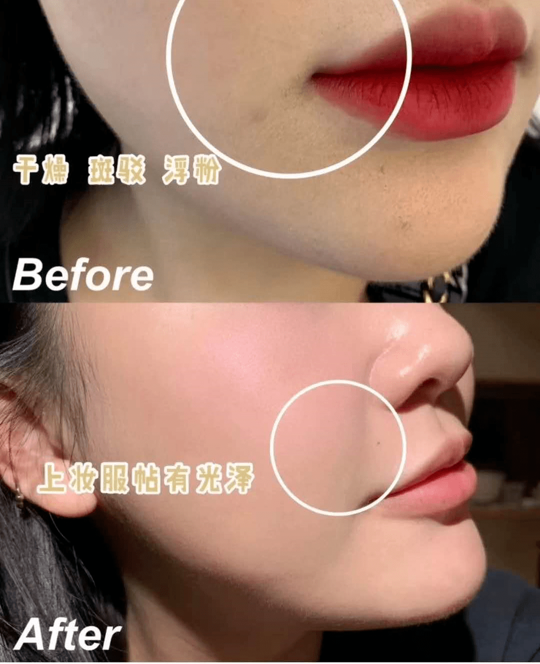 色斑|连抹7天,斑没了,皮肤真的白一度!