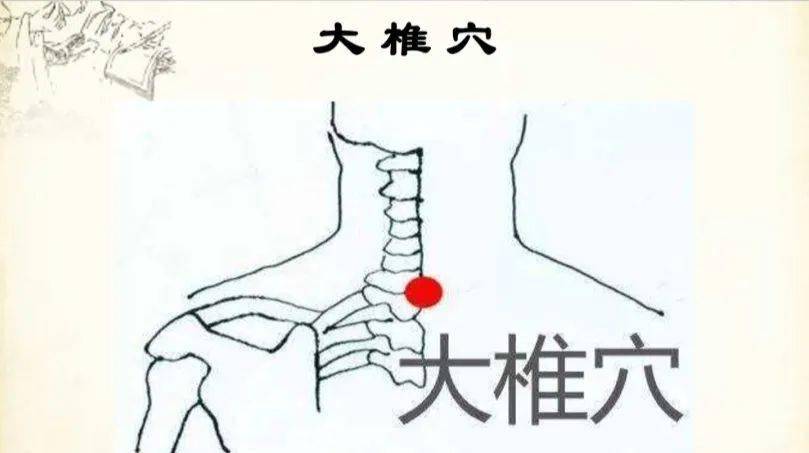 贴敷主要有这样几个穴位:  大椎 肺腧 定喘 天突