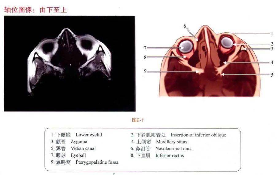 眼眶mri断层解剖速查图谱|眼科基础解剖精选图集_手机搜狐网