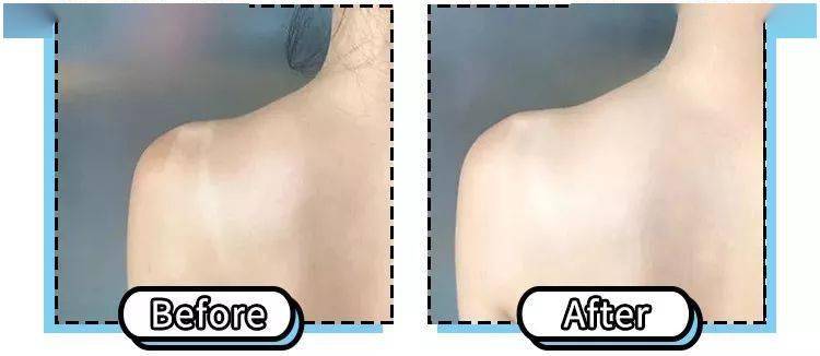 女人|懂得往脸上抹油的女人，还打个P玻尿酸！