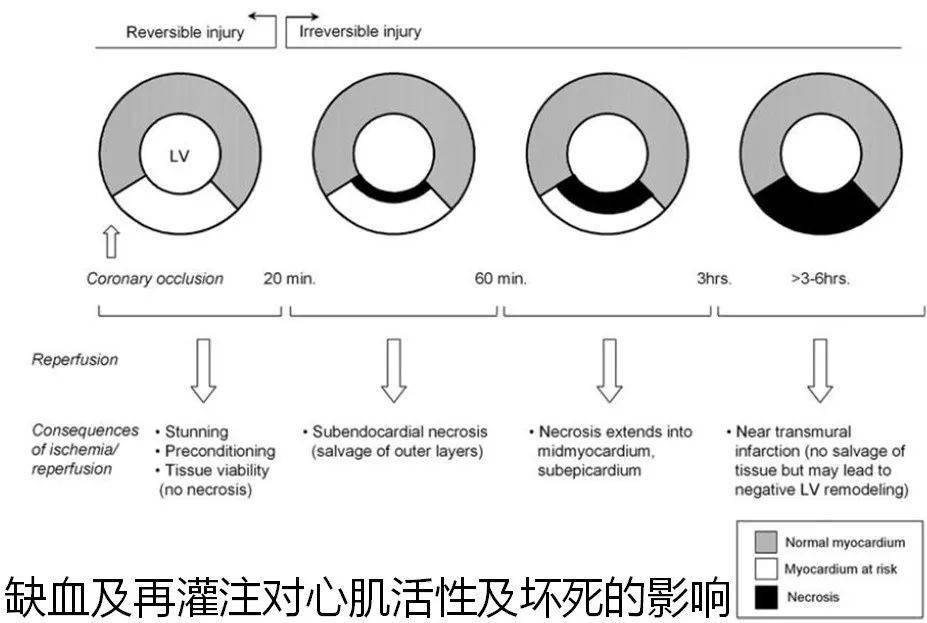 护士了解一下:心血管疾病最全影像图解