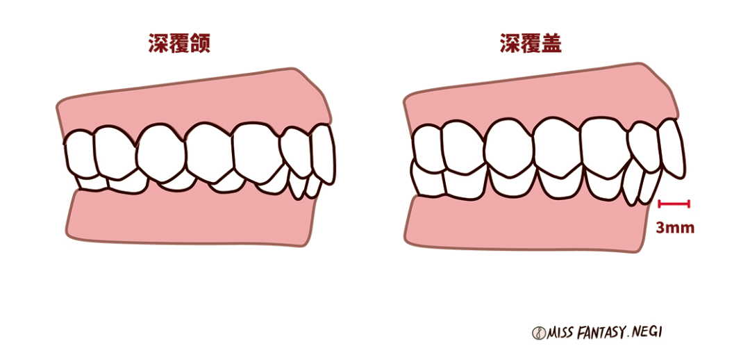 嘴唇|听说80%的人都在为这个颜值bug苦恼