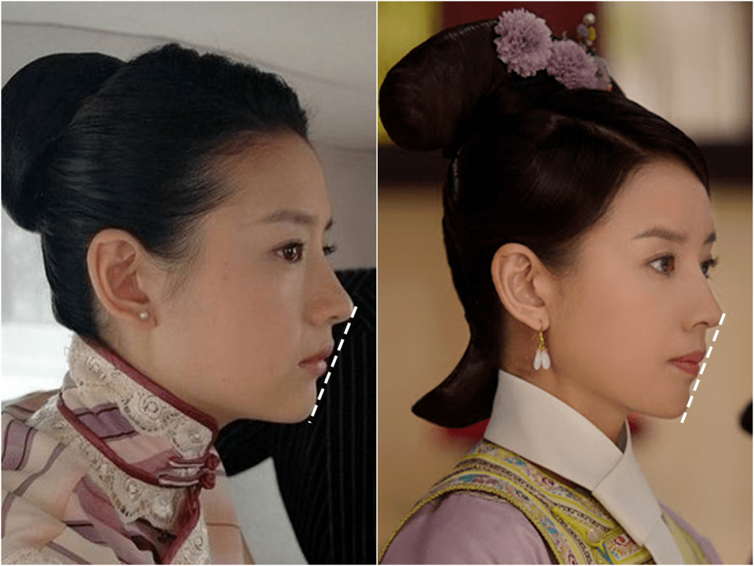 嘴唇|听说80%的人都在为这个颜值bug苦恼