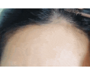 脸型|不整容也可以改变脸型？守住发际线就够了！