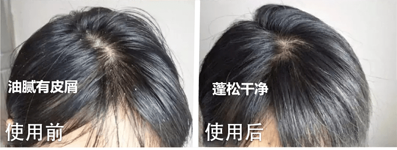 什么|连头发都快拼没了，你拿什么安身立命？