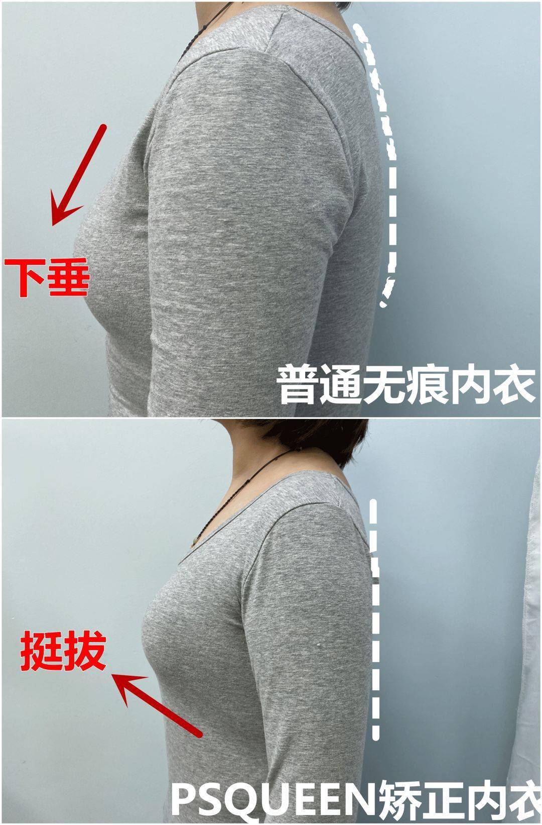 换上psqueen矫正内衣,  胸线几乎上移5cm.