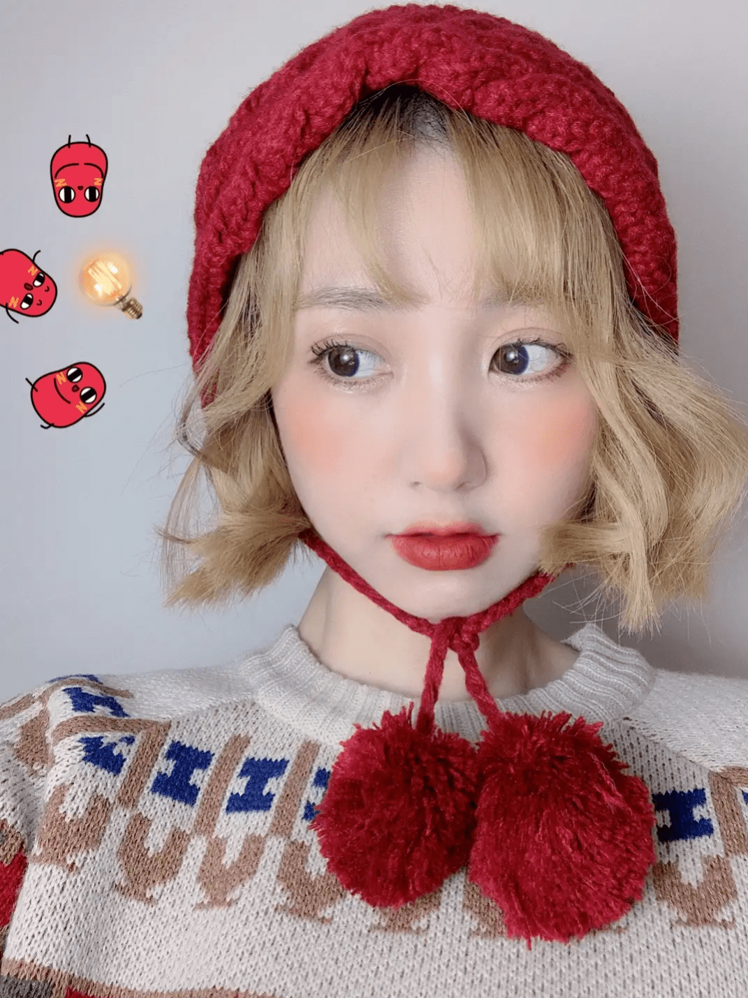 双杠|“悲伤蛙”，双杠眼……双眼皮到底怎么割？！