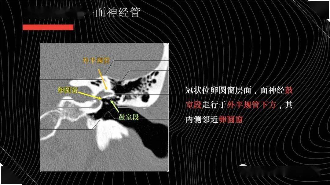 面神经解剖与常见疾病