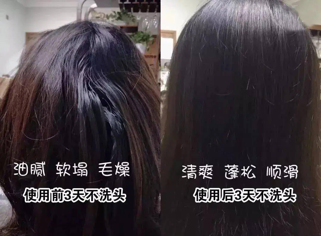 头发|洗了20几年的头，到底该洗“头皮”还是“头发”？