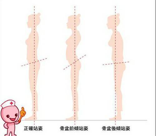 坐姿如何判断骨盆前倾/后倾的问题,在这里给大家介绍一个简单的小