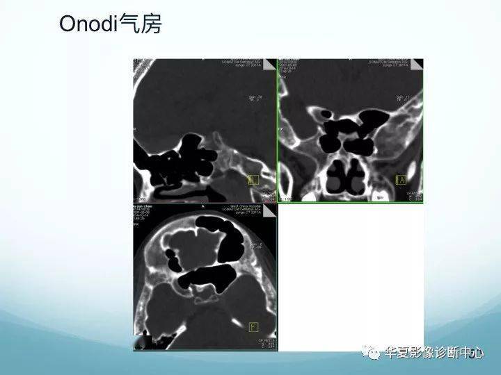 一个好的方法技巧一定源于一个好的理论知识更多知识返回搜狐,查看