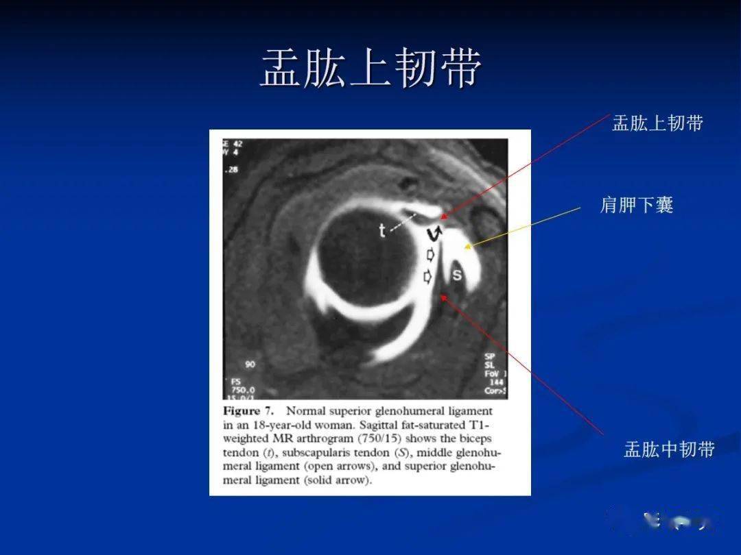 肩袖解剖及损伤的临床及mri诊断