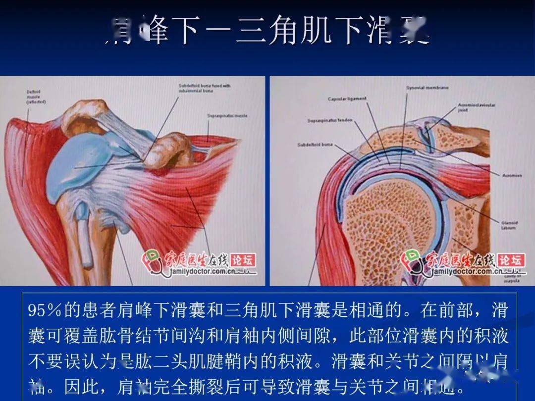 四个滑囊:肩峰下滑囊,三角肌下滑囊,喙突下滑囊,肩胛下滑囊.