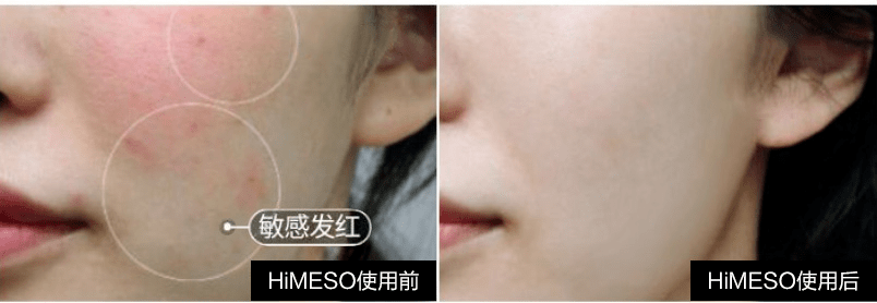 效果|她也太会玩了…