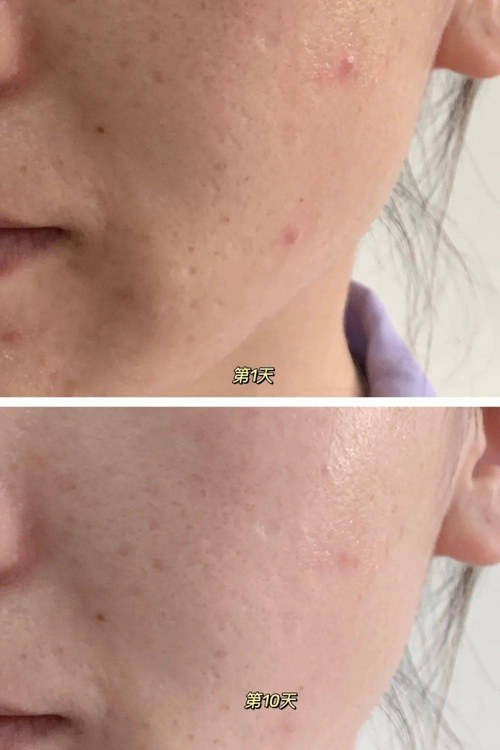 肌肤|凭什么别人都美得那么高级？