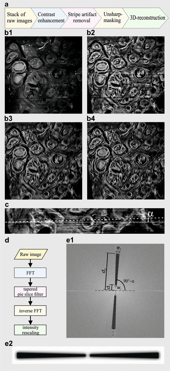 组织|【新技术】3D肿瘤显微镜可对肿瘤组织进行三维角度分析，简化肿瘤诊断！价格便宜易操作！