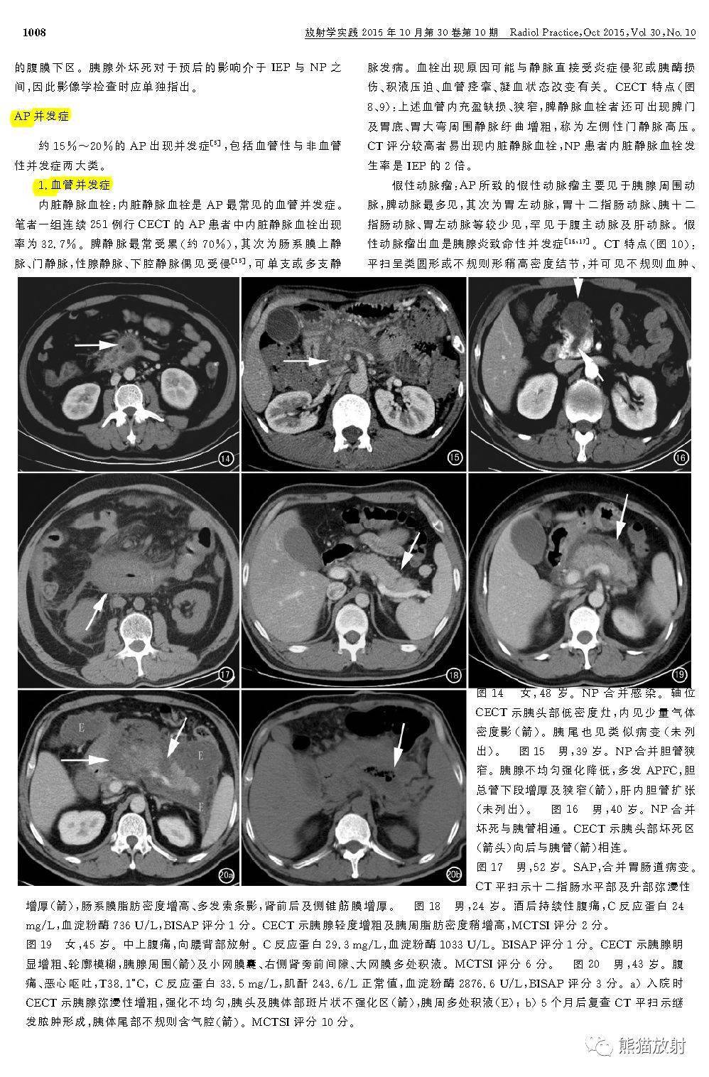 急性胰腺炎新分类相关术语和并发症及mctsi评分