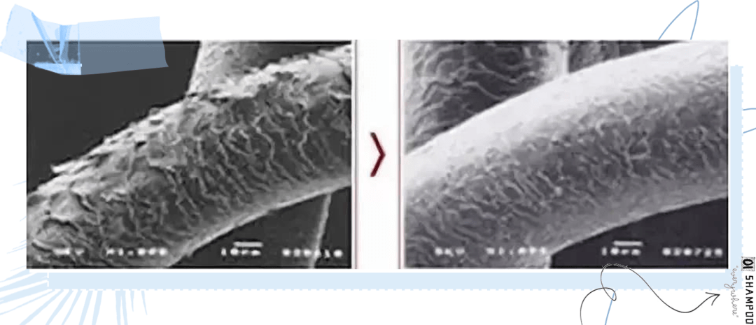 克兰|头上抠下的“白泥”，居然不是头皮屑？脱发头油都是因为它？