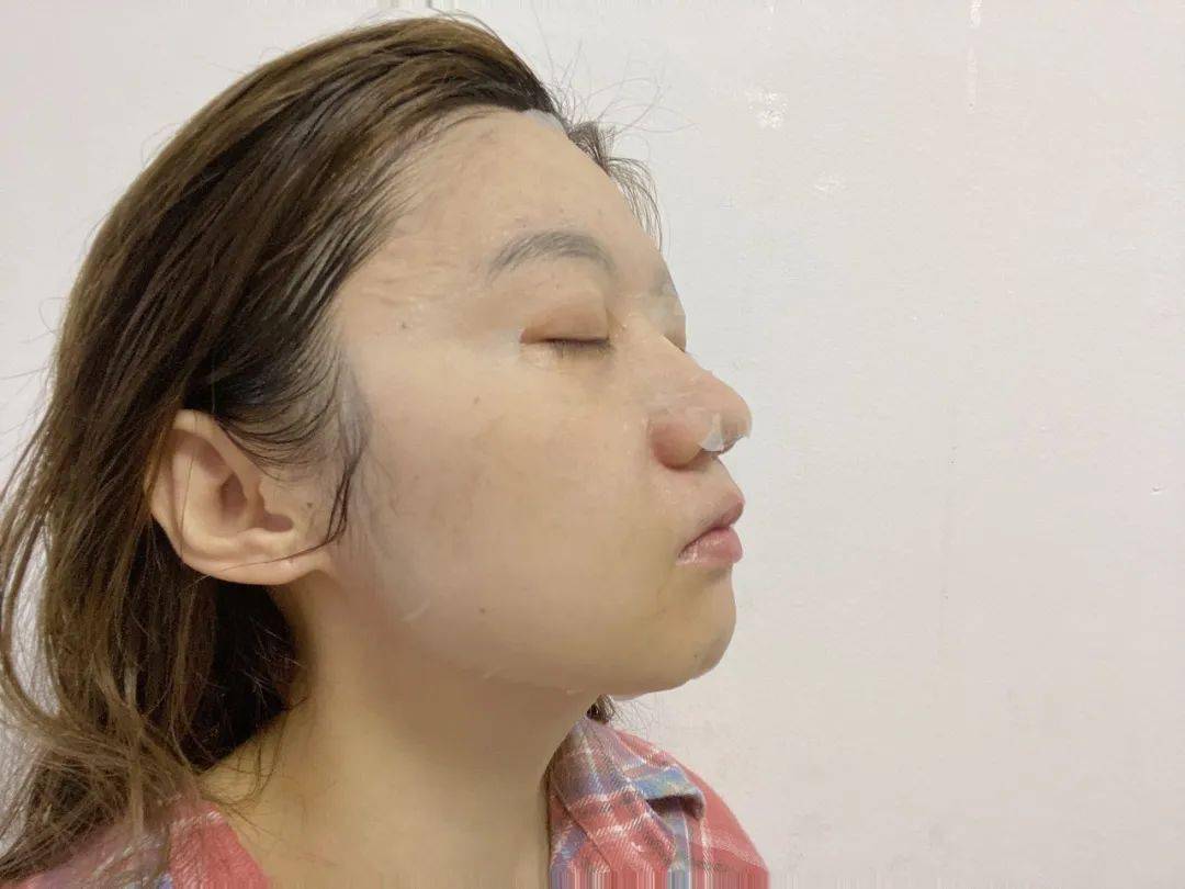 皮肤|入冬必备4件毛衣